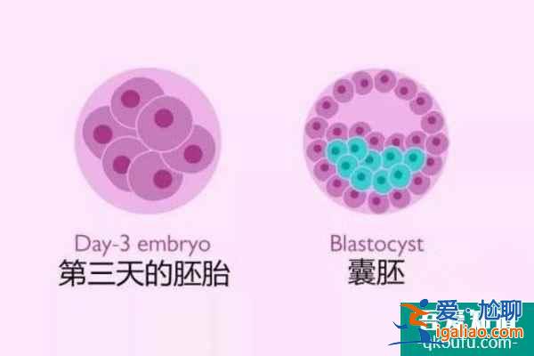 試管嬰兒有哪些優勢?具體看這4點? 試管嬰兒有哪些優勢?具體看這4點?