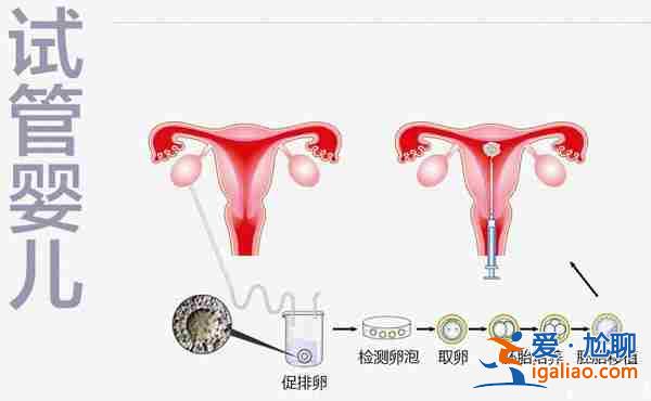 武漢試管私立醫(yī)院有哪些,三甲醫(yī)生權(quán)威解讀,費(fèi)用情況？