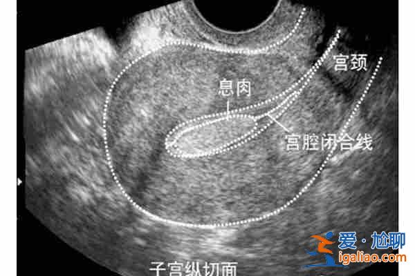 鄭州正規(guī)助孕機(jī)構(gòu)_「建造新生命」？