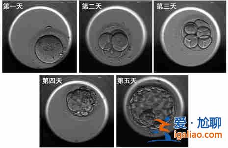 今日〖第三代試管嬰兒成功率高嗎〗高齡助孕呂進峰生子助孕公司？