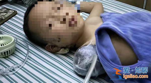 7歲男童被炮仗扎傷手臂截止，當(dāng)?shù)鼐揭呀?jīng)展開(kāi)調(diào)查[警方]？