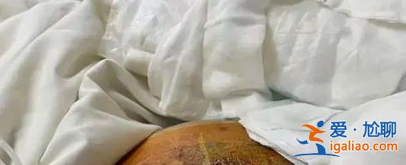 6次手術花上百萬元 現在還躺在醫院？