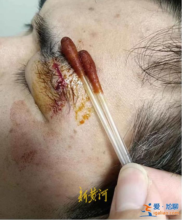 房客酒店內被外來醉酒男無故暴打 杭州萬豪酒店稱“自己也是受害者”？