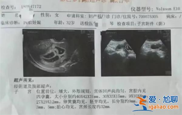 四胞胎寶媽產后9個月再次懷上四胞胎[寶媽]？