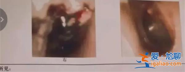 3歲娃疑被老師掌摑致聽力受損，幼兒園老師應以身作則[以身作則]？