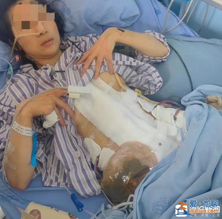 為什么我逃也逃不了 離也離不掉？