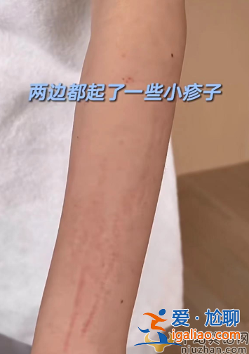王石妻子田樸珺裹浴巾出鏡惹爭議!紅腫傷痕明顯，素顏變化模樣大