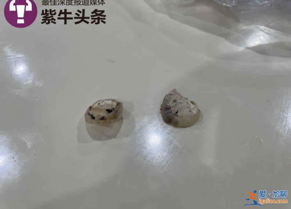 食堂飯菜異物是鴨子眼球鞏膜？現(xiàn)場(chǎng)實(shí)測(cè)鴨眼球鞏膜比鴨眼外表大數(shù)倍？