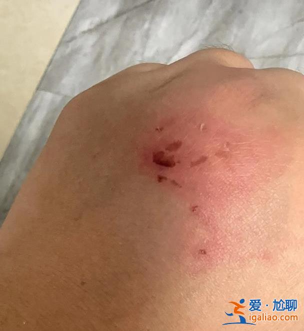 牽狗進電梯與鄰居發生糾紛 女子發多條視頻稱遭毆打羞辱？