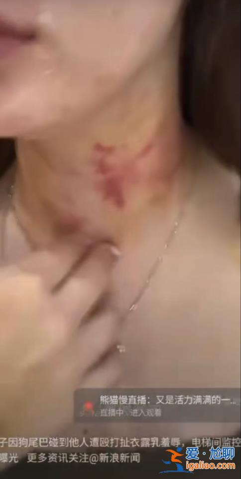 牽狗進電梯與鄰居發生糾紛 女子發多條視頻稱遭毆打羞辱？