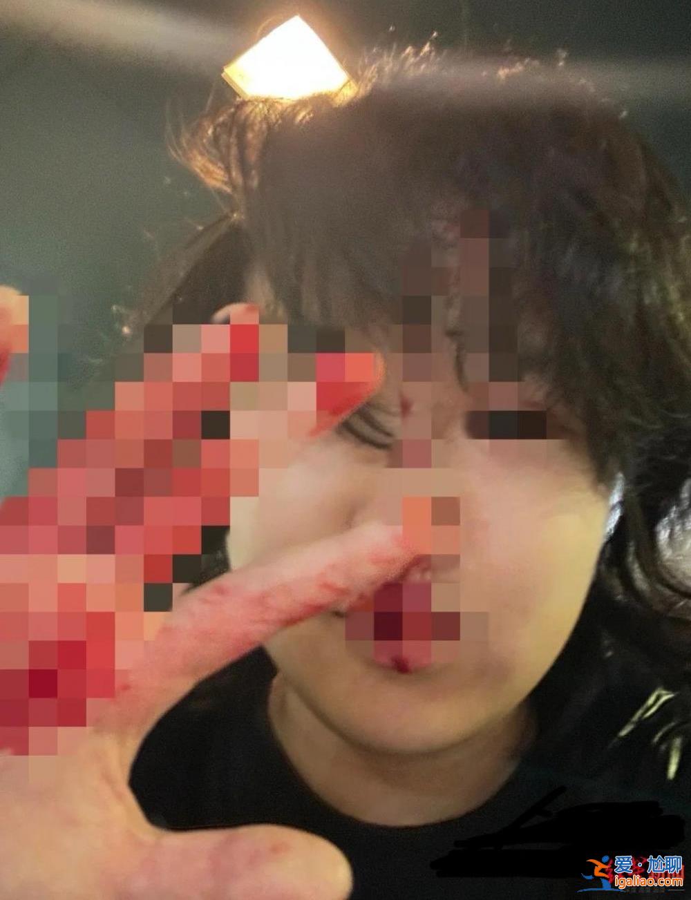 警察說是彈珠槍 能活著真好？