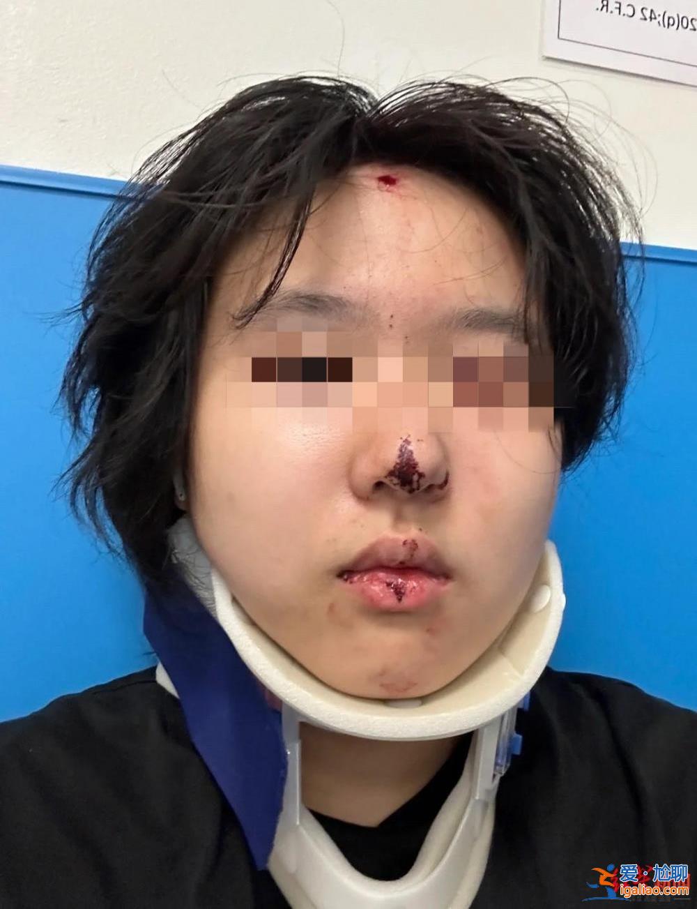 警察說是彈珠槍 能活著真好？
