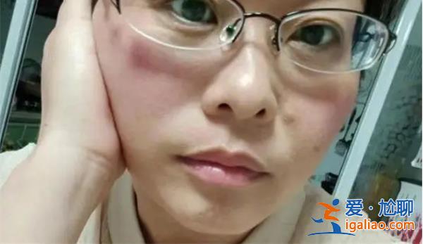 斷崖式衰老女子本以為能漂亮過余生[漂亮過余生]？