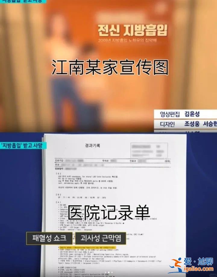 赴韓整形兩周內(nèi)三次抽脂 20多歲中國女孩不幸身亡 韓國警方計劃尸檢？