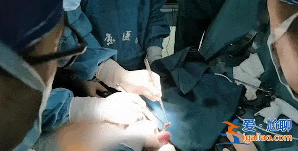 全球首例豬腎移植患者去世 異種移植活不過2個月？專家發聲？