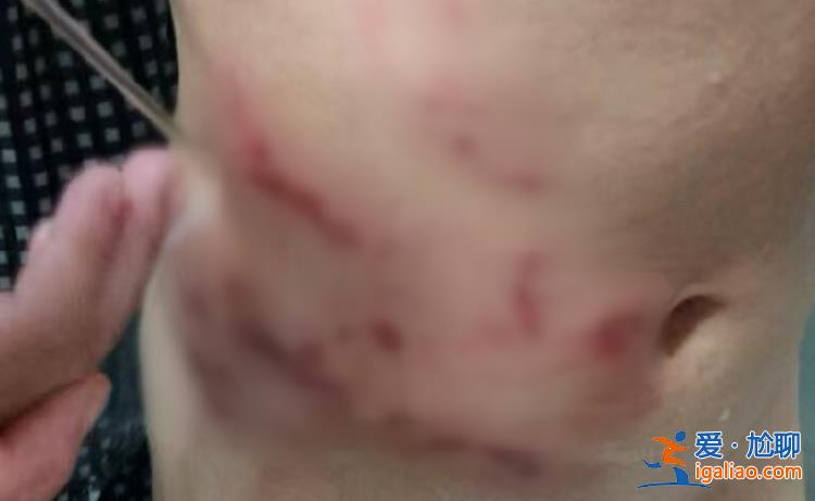 狗被打死 主人至今沒找到？