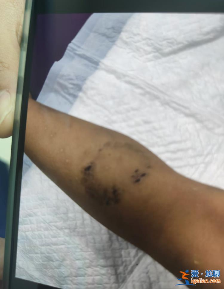 警方說監控過于暴力 僅口頭轉述？
