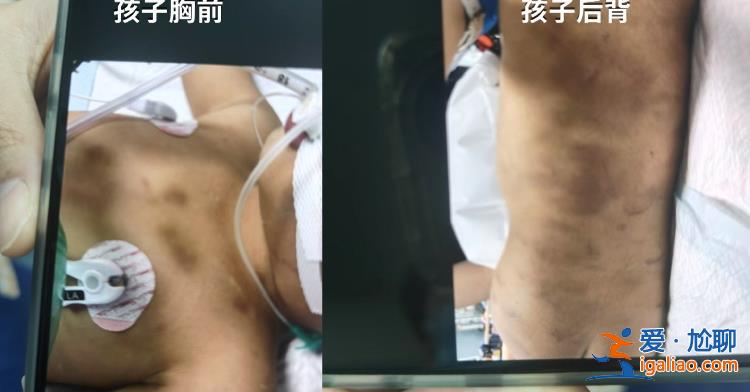 警方說監控過于暴力 僅口頭轉述？